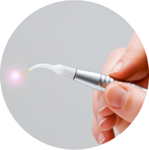 Das Bild zeigt einen Laser für die Zahnmedizin und dient als Titelbild für das Thema "Laser beim Zahnarzt".